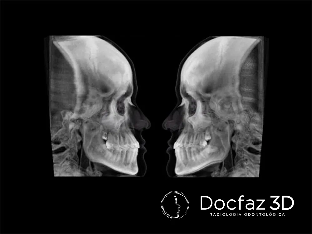 Imagem tomográfica ilustrativa — Ortopedia Funcional